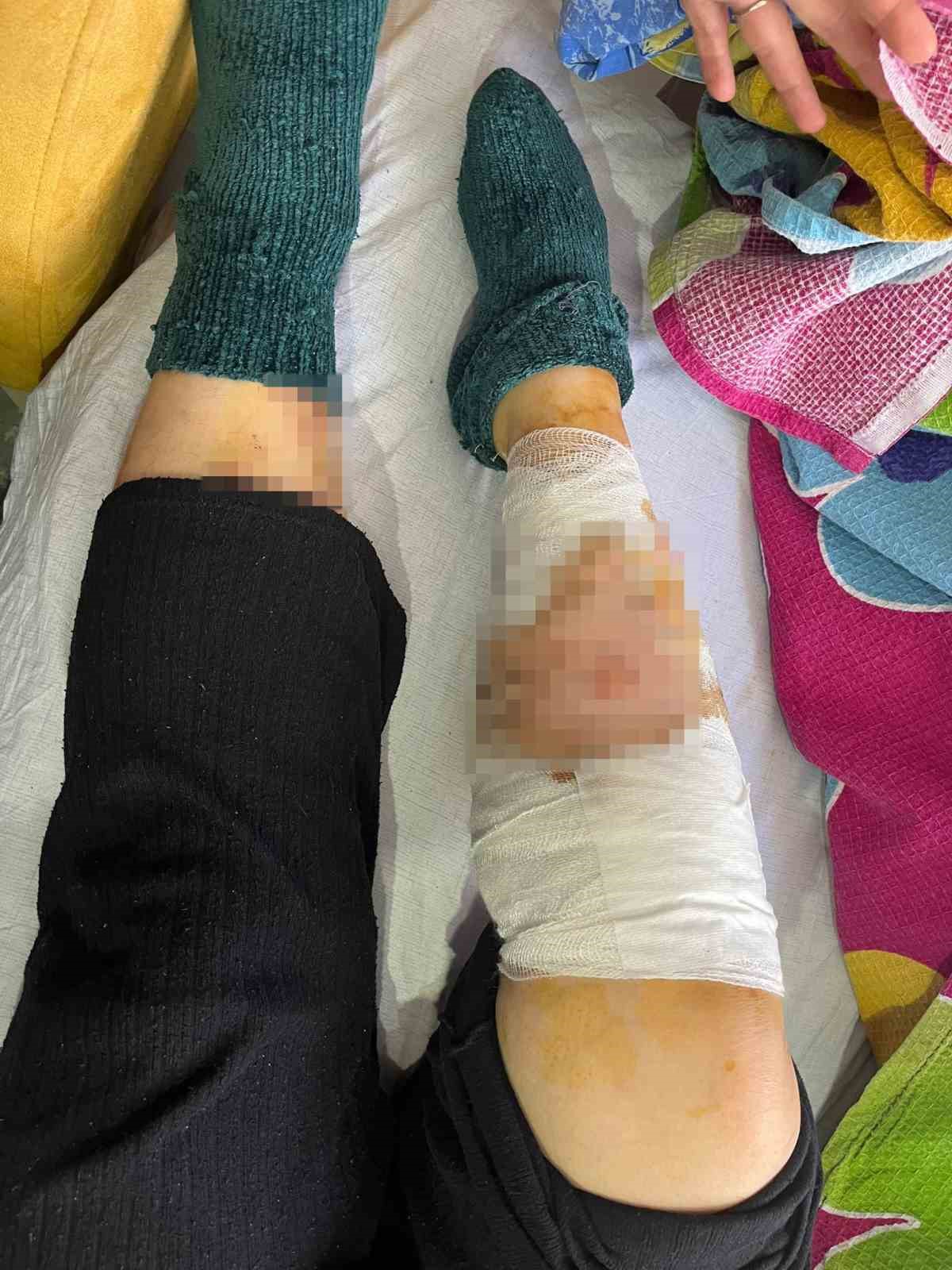 Köpek sürüsünün saldırısında ağır yaralanan yaşlı kadın: "Kolumu, elimi, başımı ve bacağımı parçaladılar"
