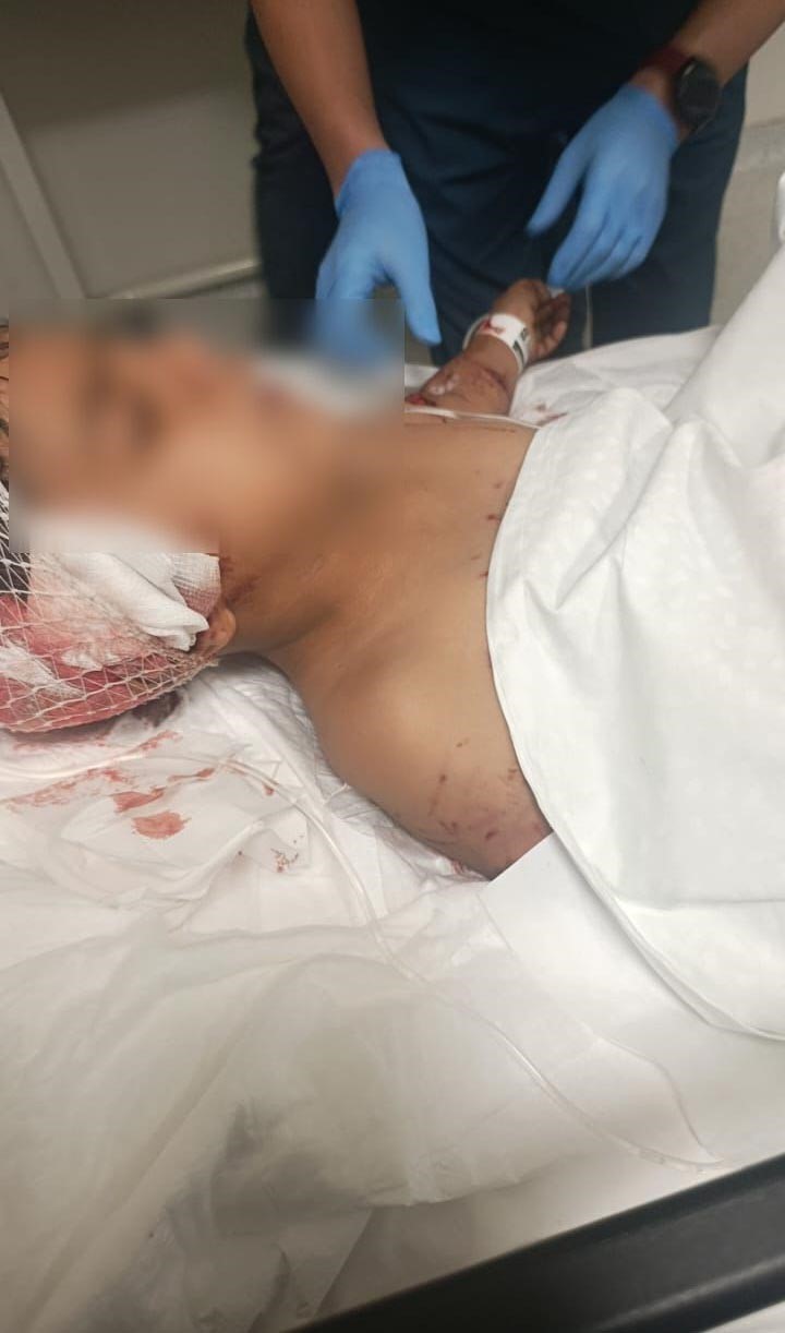 Köpeklerin saldırısına uğrayan çocuğu kurtaran komşu: "10 saniye daha geç kalsaydım çocuğun anca parçalarını bulabilirlerdi"
