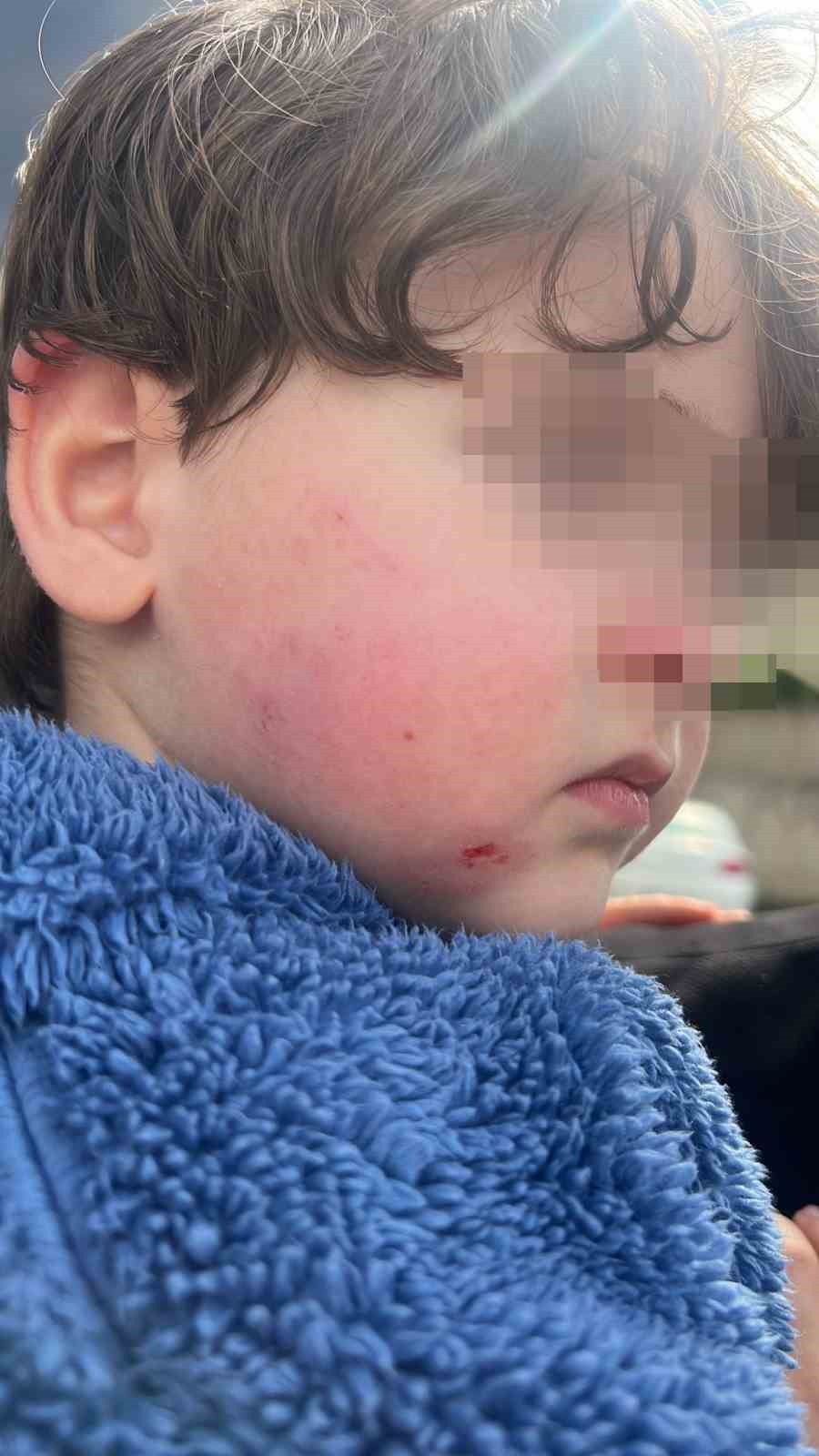 Kreşe bıraktığı çocuğunu darp edilmiş halde aldı
Kreşe bıraktığı çocuğunu darp edilmiş halde aldı