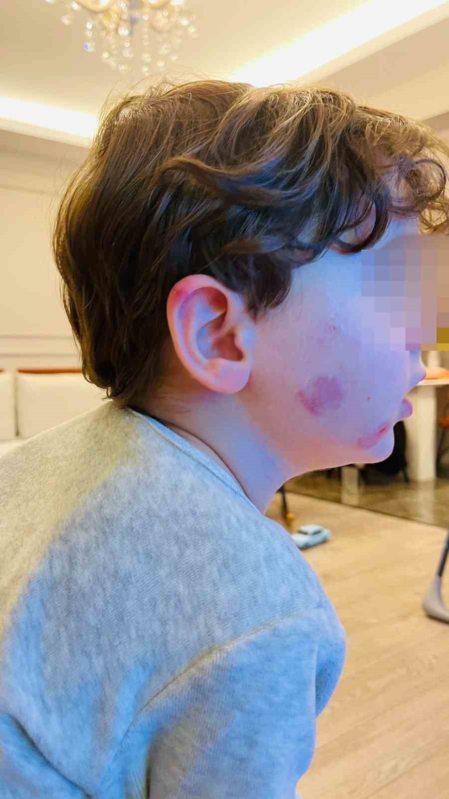 Kreşe bıraktığı çocuğunu darp edilmiş halde aldı
Kreşe bıraktığı çocuğunu darp edilmiş halde aldı