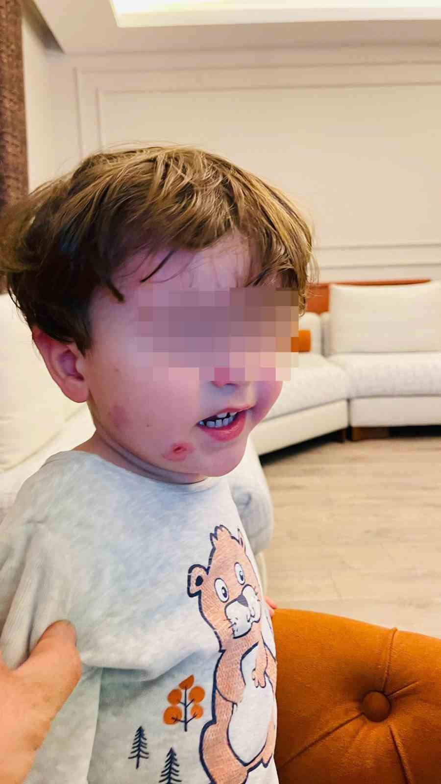 Kreşe bıraktığı çocuğunu darp edilmiş halde aldı
Kreşe bıraktığı çocuğunu darp edilmiş halde aldı