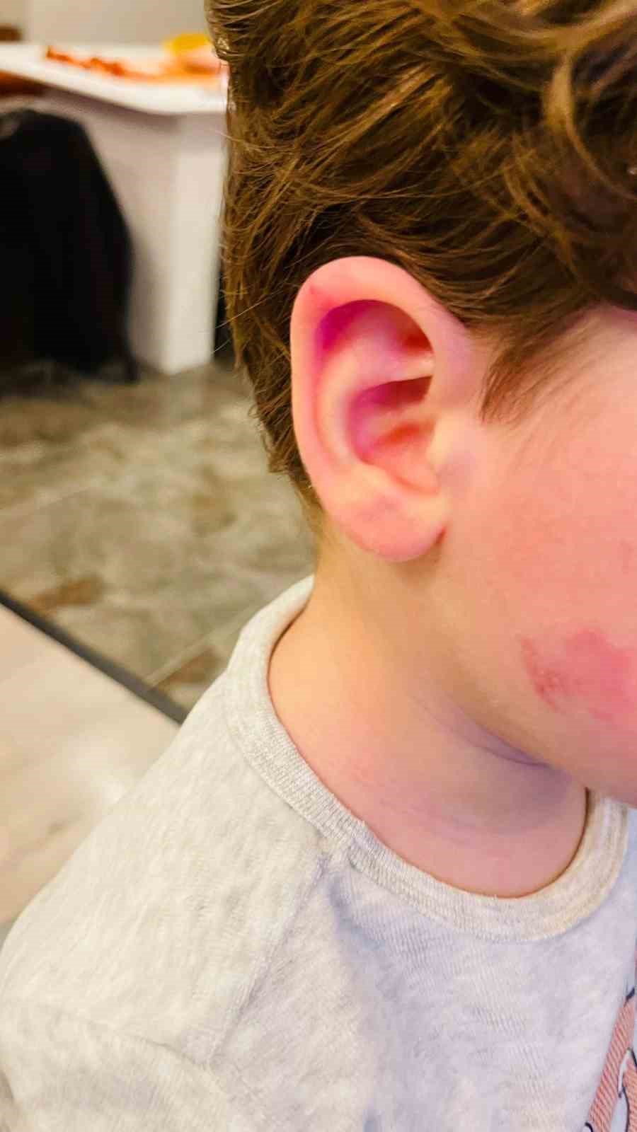 Kreşe bıraktığı çocuğunu darp edilmiş halde aldı
Kreşe bıraktığı çocuğunu darp edilmiş halde aldı