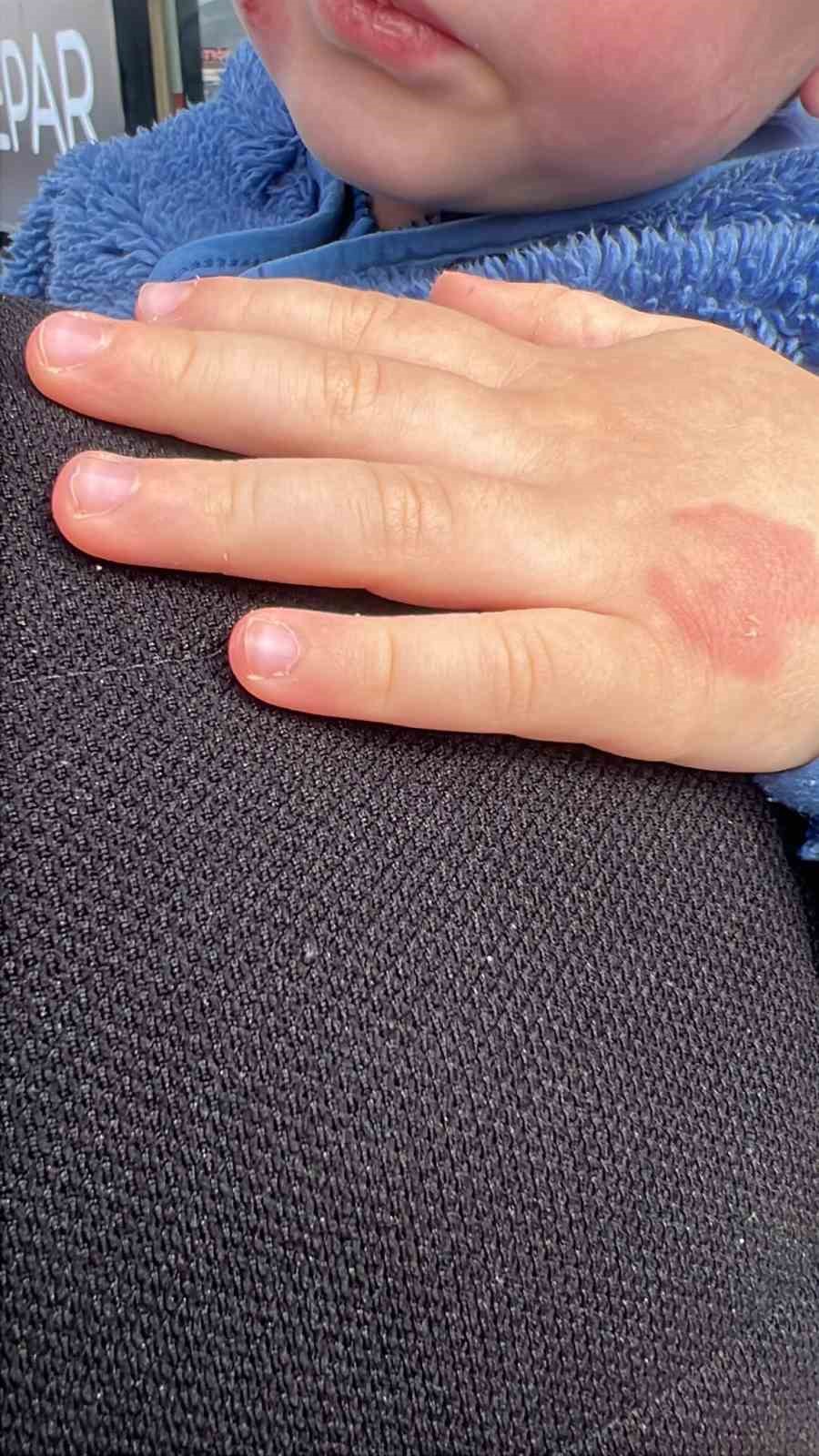 Kreşe bıraktığı çocuğunu darp edilmiş halde aldı
Kreşe bıraktığı çocuğunu darp edilmiş halde aldı