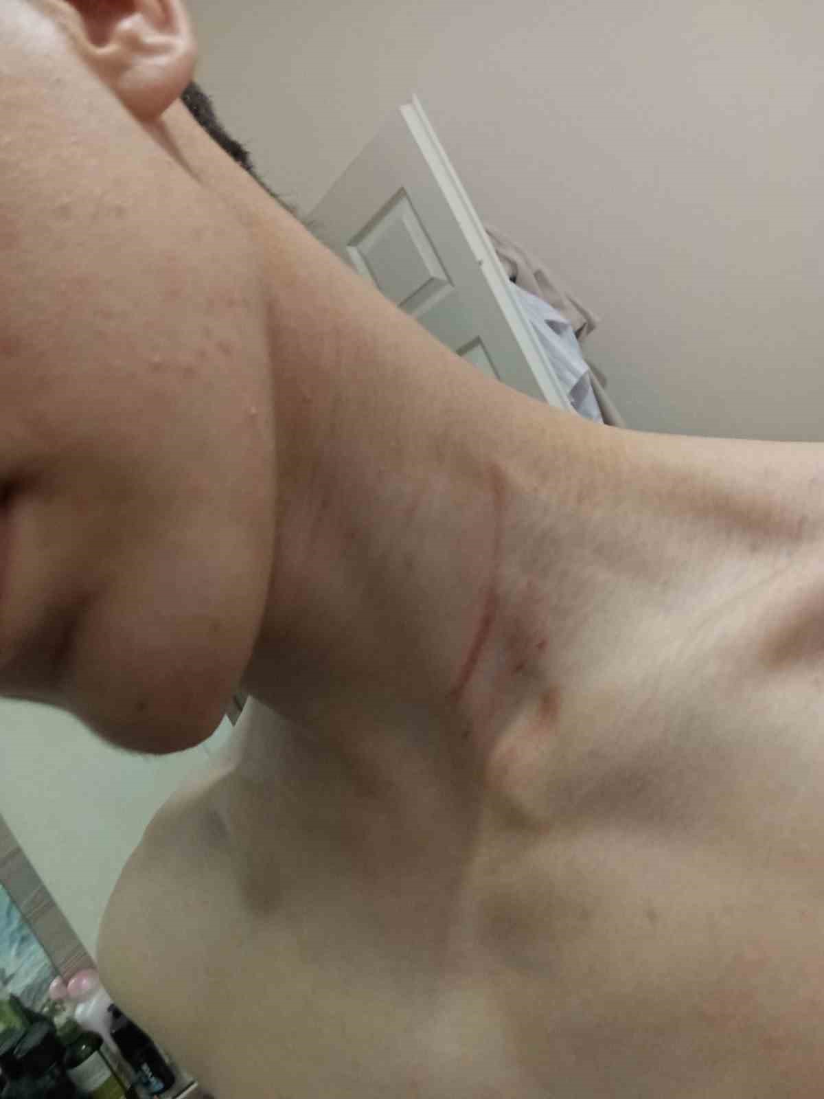 Küçükçekmece’de 16 yaşındaki çocuğu "fotoğraf çektin" iddiasıyla darbettiler
Küçükçekmece’de 16 yaşındaki çocuğu "fotoğraf çektin" iddiasıyla darbettiler