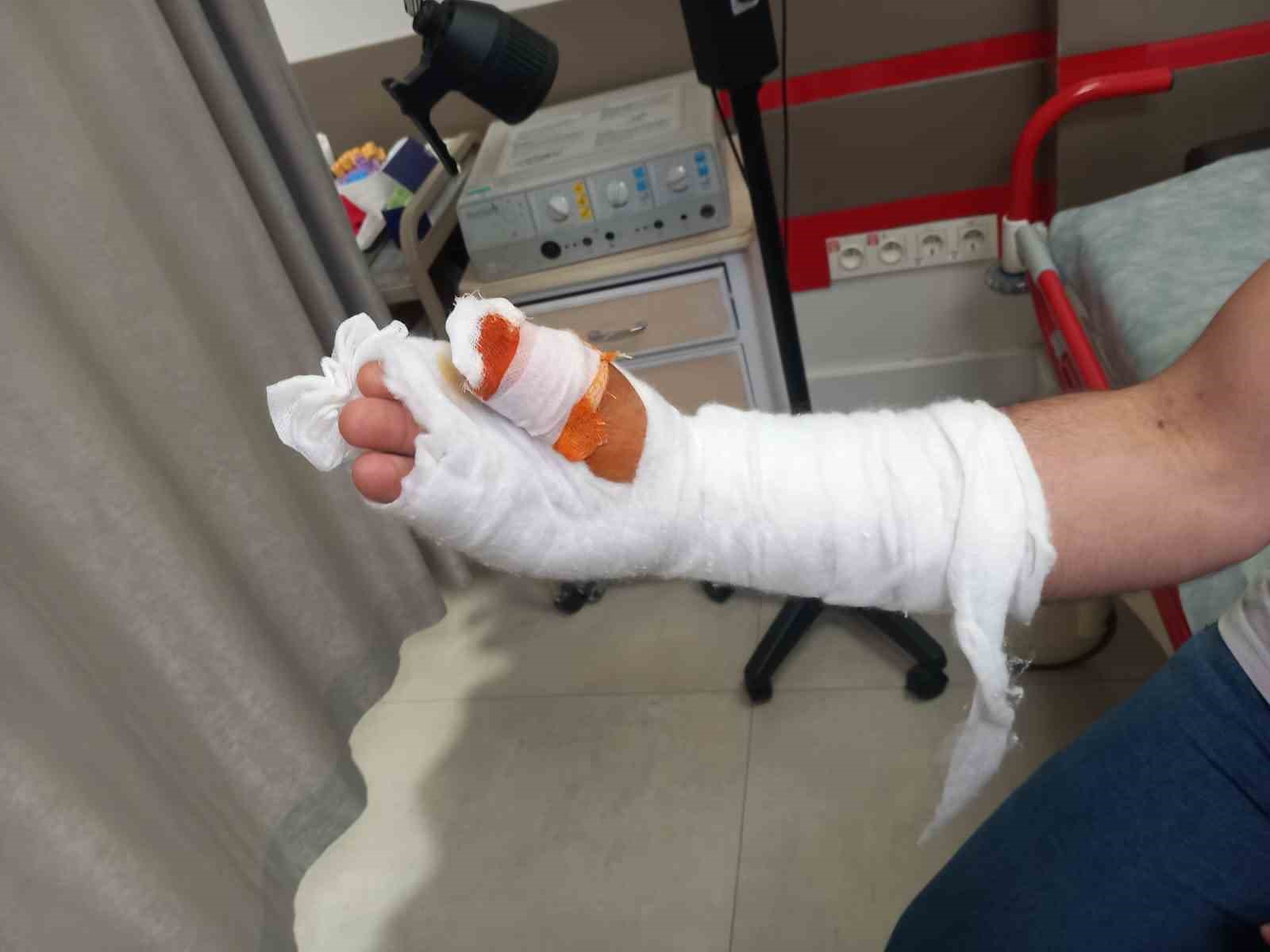 Kurban Bayramı’nda parmağını kesti, başına gelmeyen kalmadı
