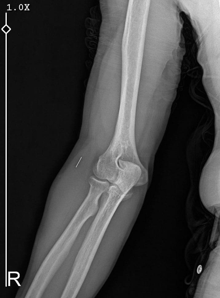 Kurban Bayramı’nda parmağını kesti, başına gelmeyen kalmadı
