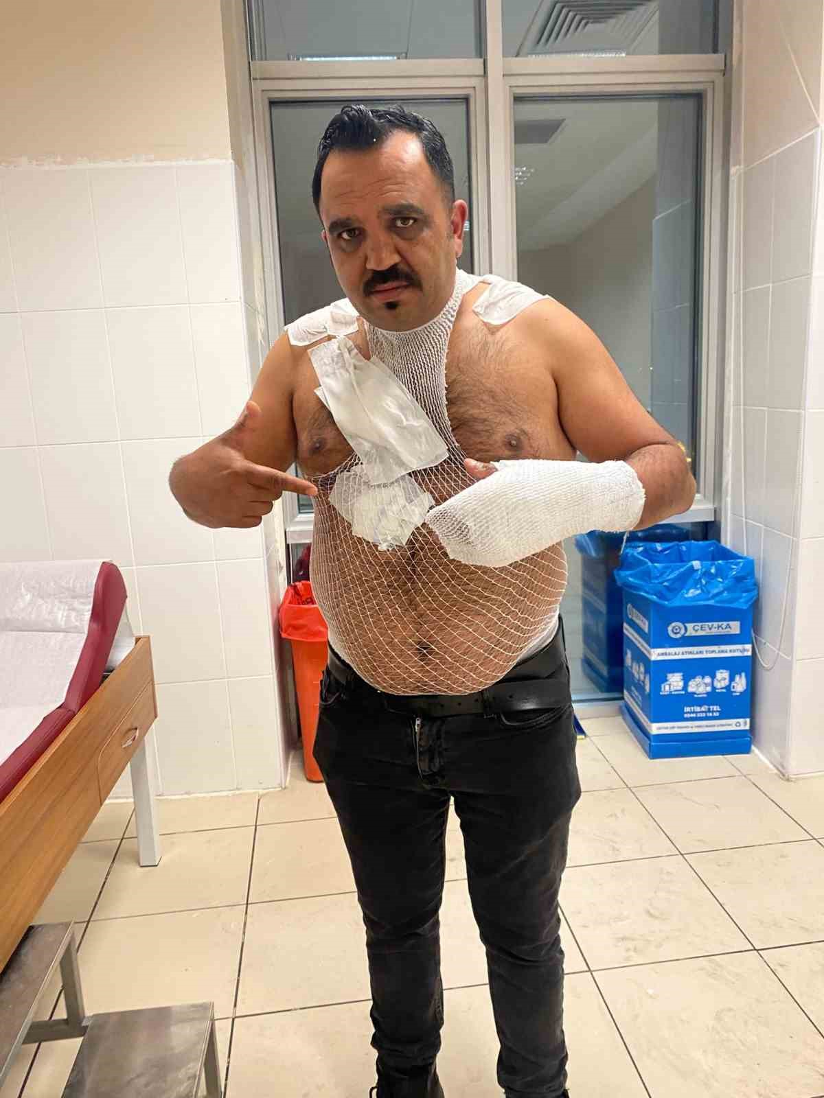 Meşhur tostçu, soğuk havada şov yapmak isterken kendini yaktı
