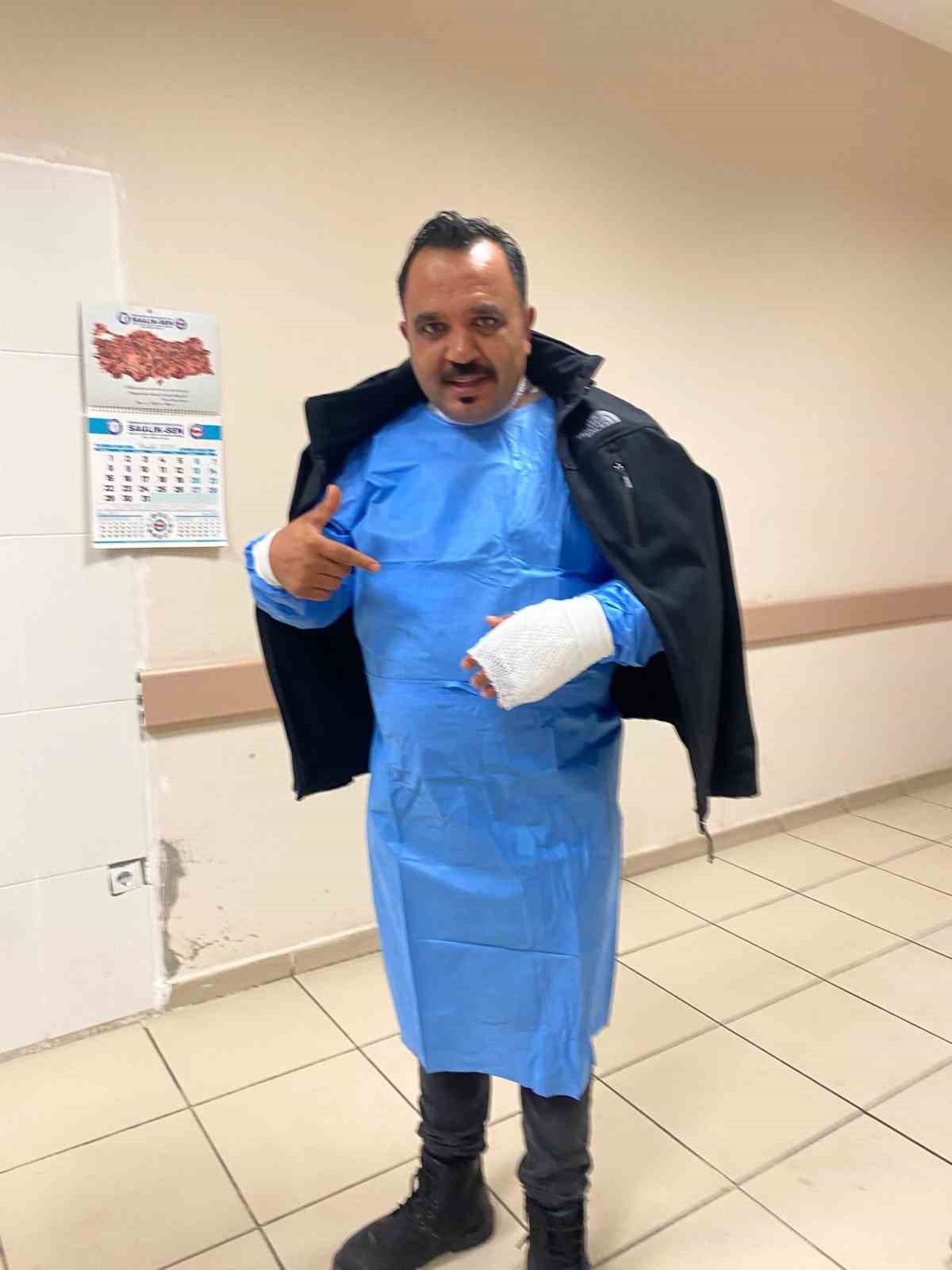 Meşhur tostçu, soğuk havada şov yapmak isterken kendini yaktı
