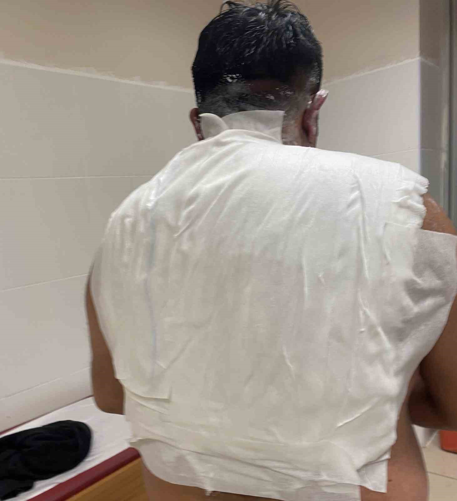 Meşhur tostçu, soğuk havada şov yapmak isterken kendini yaktı
