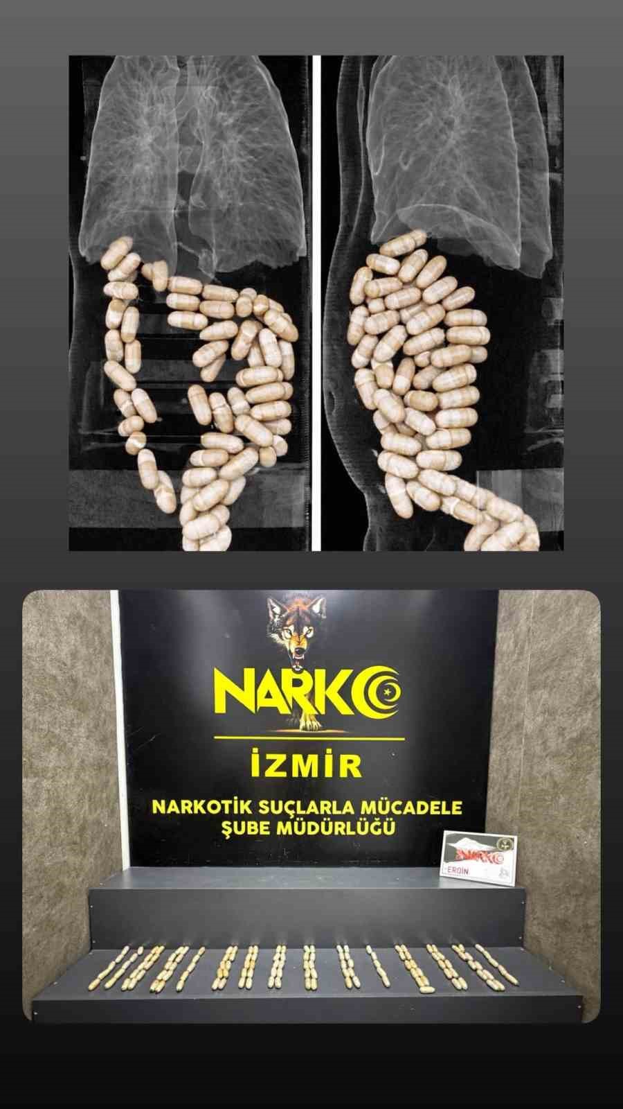 Midesinde uyuşturucu taşıyan şüpheliler tutuklandı
