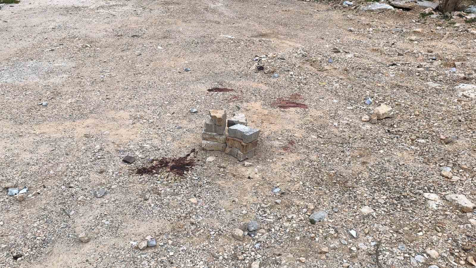 Muğla’da Ramazan topu patlamasında 19 yaşındaki genç ağır yaralandı
