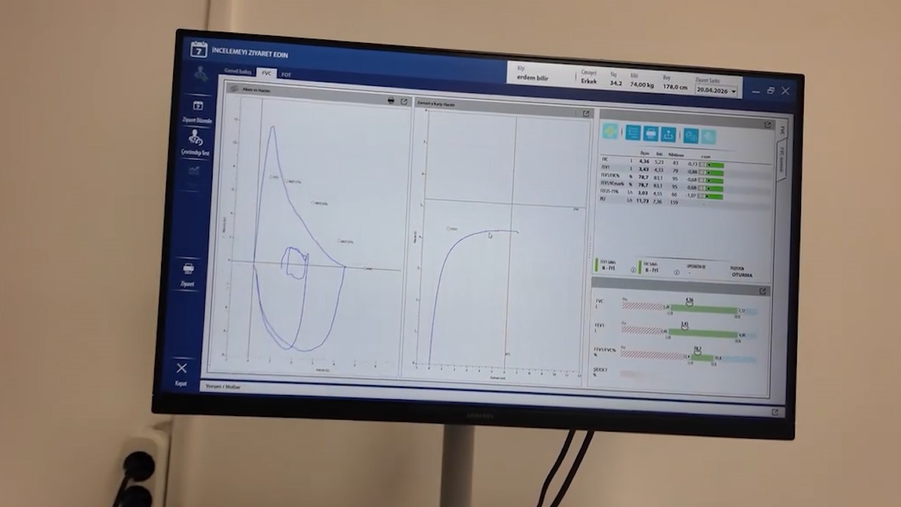 Niğde Eğitim ve Araştırma Hastanesi’nde solunum testlerinde yeni dönem
