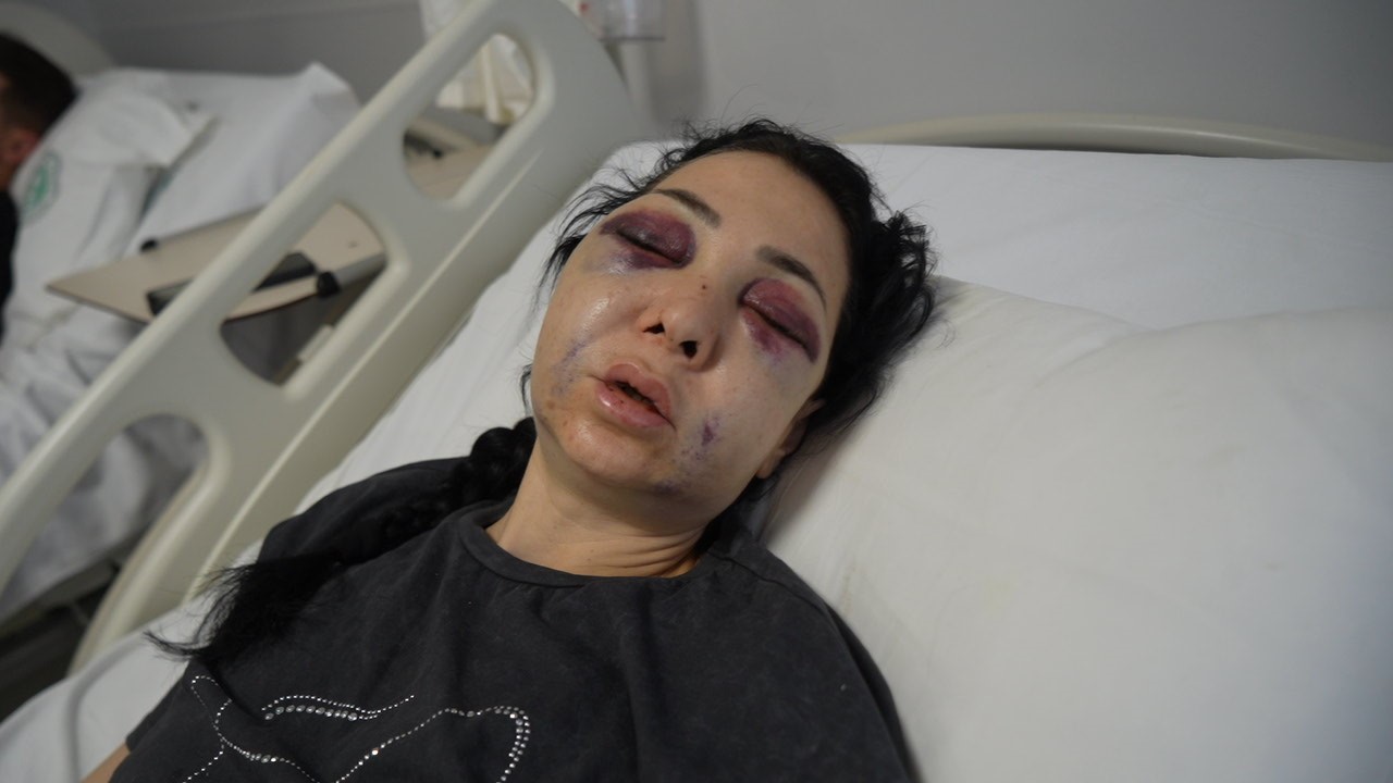 Oğlunun gözü önünde anneyi öldüresiye dövdüler: "’Küfür etmeyin’ dedik diye bu hale geldim"
Oğlunun gözü önünde anneyi öldüresiye dövdüler: "’Küfür etmeyin’ dedik diye bu hale geldim"