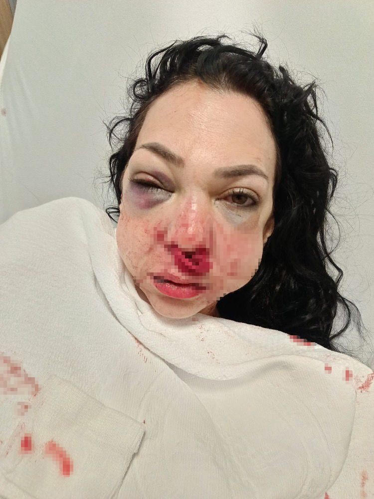 Oğlunun gözü önünde anneyi öldüresiye dövdüler: "’Küfür etmeyin’ dedik diye bu hale geldim"
Oğlunun gözü önünde anneyi öldüresiye dövdüler: "’Küfür etmeyin’ dedik diye bu hale geldim"