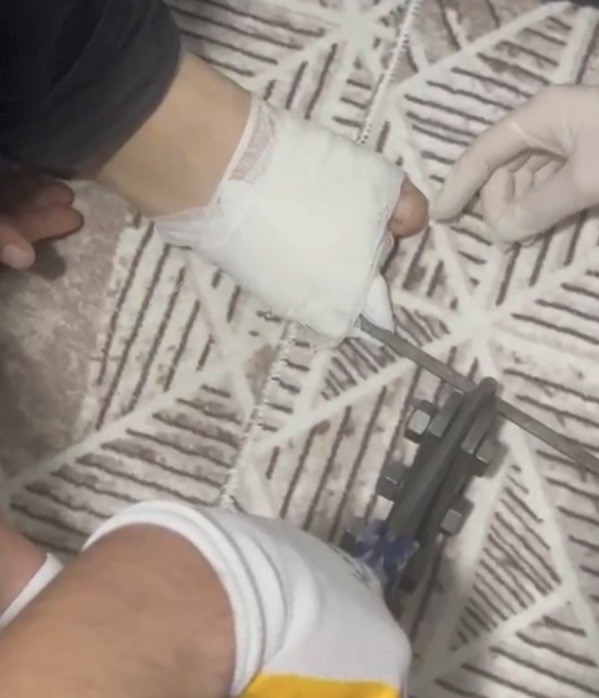 Osmaniye’de ayağına mangal şişi saplanan çocuk hastaneye kaldırıldı
