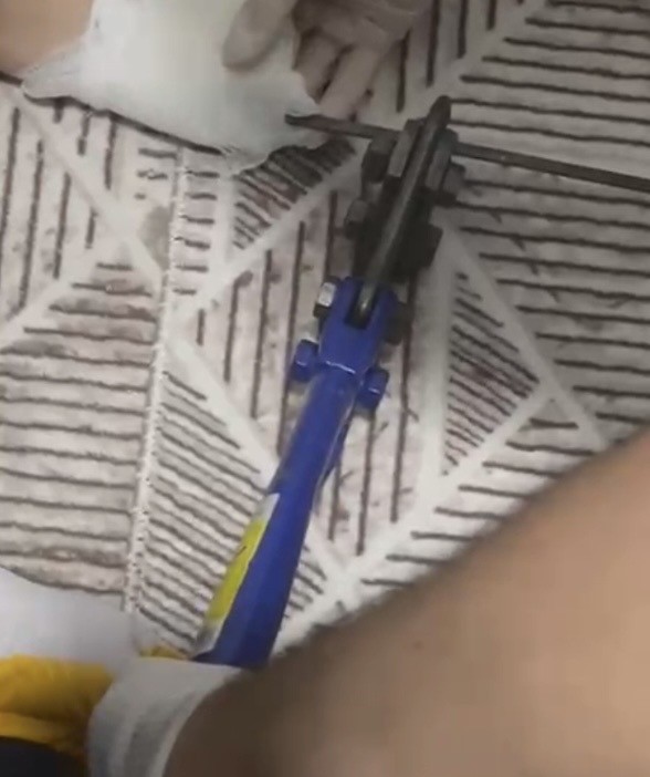 Osmaniye’de ayağına mangal şişi saplanan çocuk hastaneye kaldırıldı
