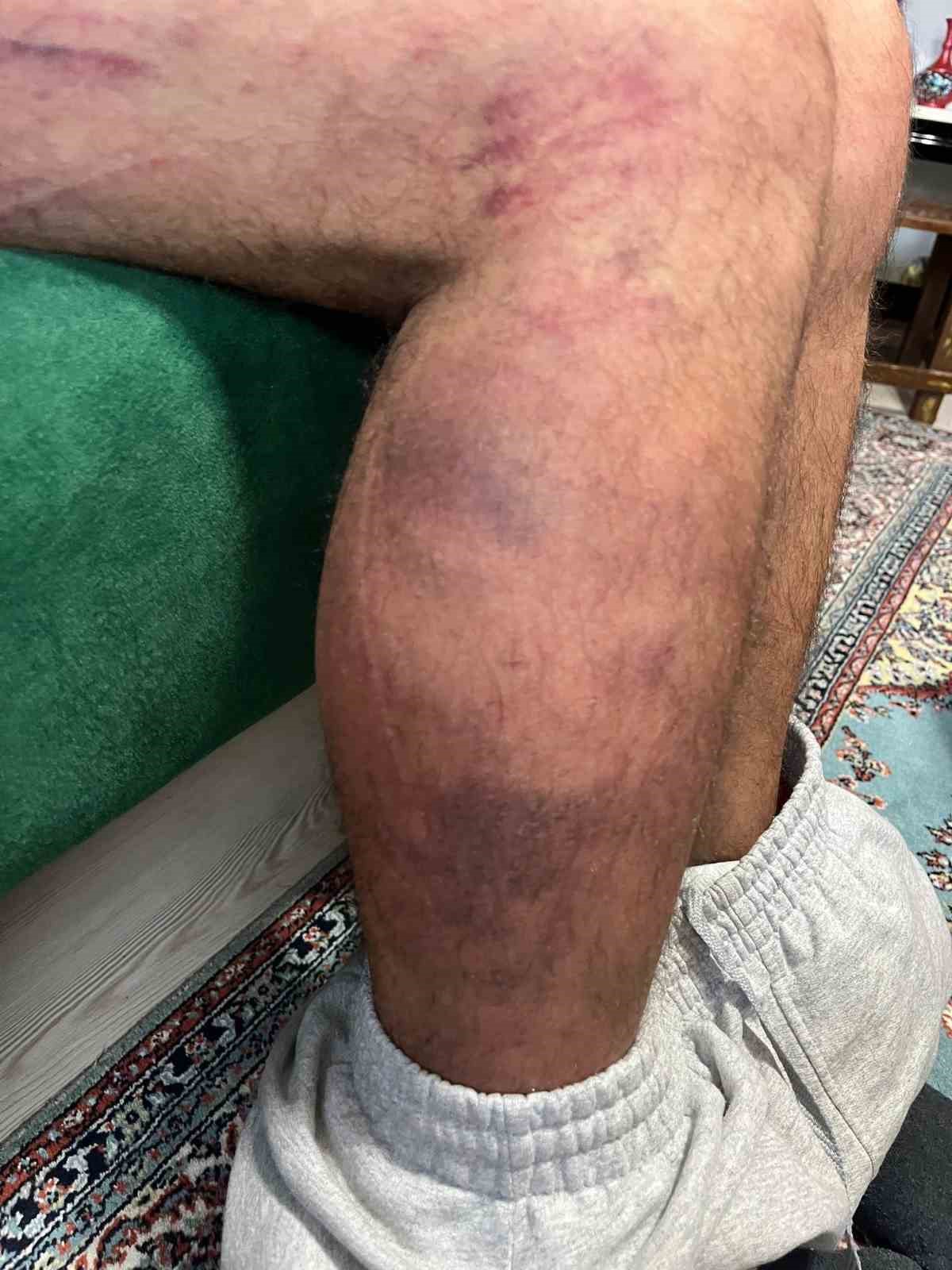 Otizmli adamı öldüresiye darp eden sanık ilk kez konuştu
