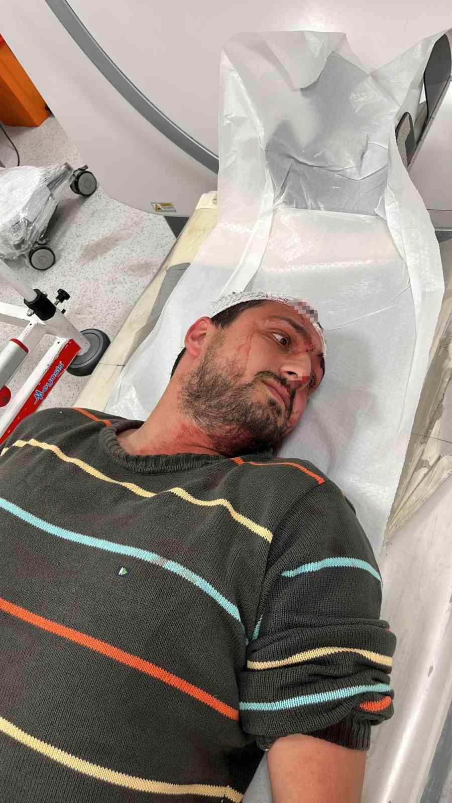 Otizmli adamı öldüresiye darp eden sanık ilk kez konuştu
