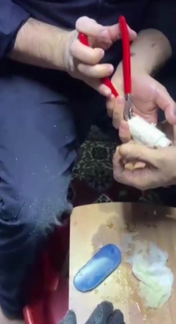 Parmağını kombi borusuna sıkıştırdı
