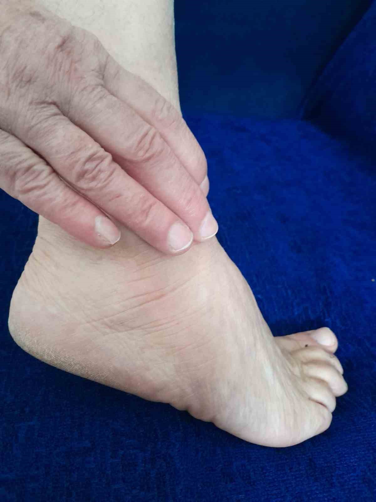 Prof. Dr. Karalezli: "Ayak bileği burkulmalarını hafife almayın"
