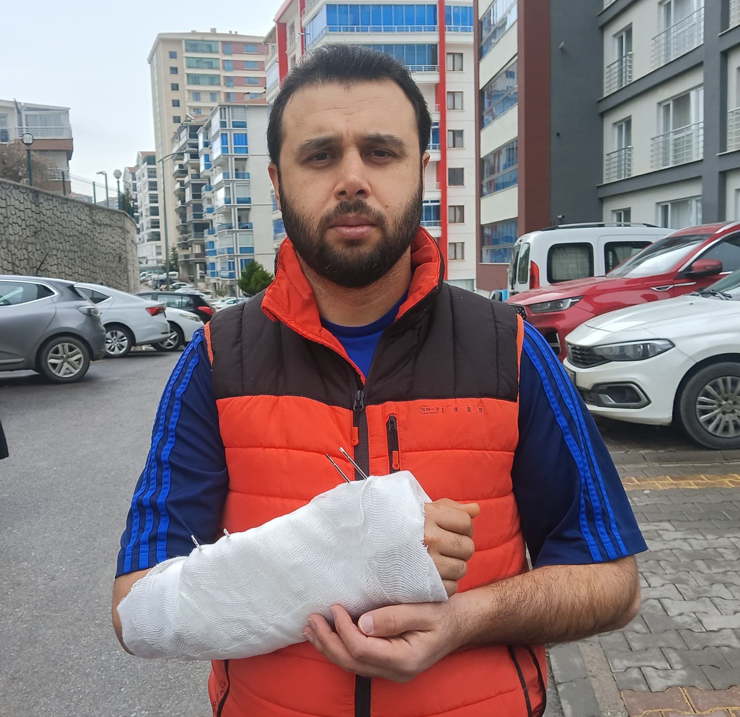 Sahipsiz köpeklerin saldırısından kaçmak isterken bileği kırıldı
Sahipsiz köpeklerin saldırısından kaçmak isterken bileği kırıldı