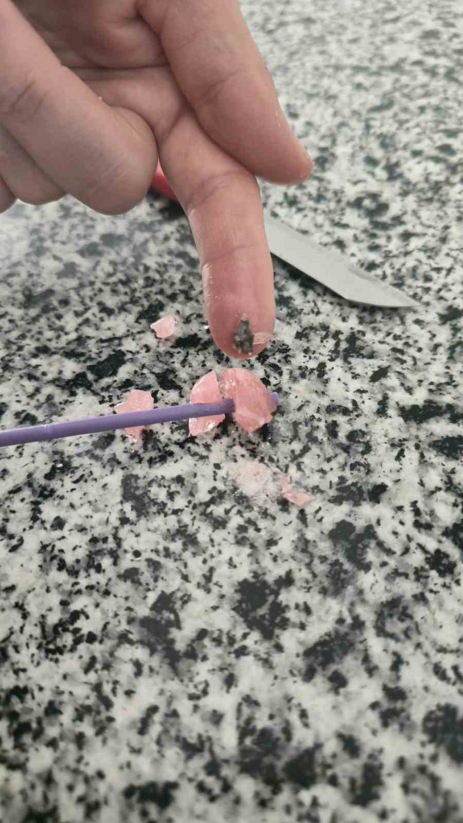 Şekerin içinden taş çıktı
