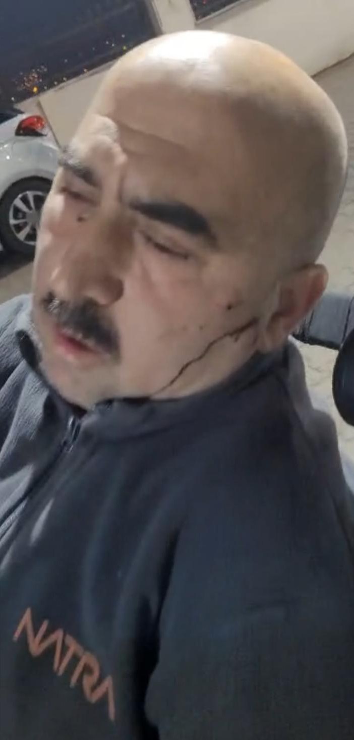 Sigortasız işçiyi patron ve patronun oğlunun darbettiği iddiası
