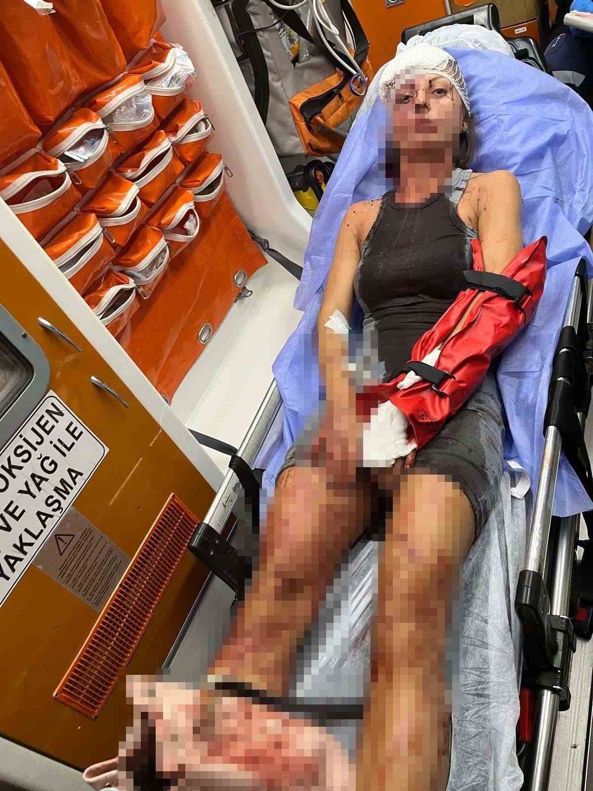 Uzaklaştırma kararı bulunan eşe sopalı saldırı davasında savcıdan 20 yıla kadar hapis talebi
