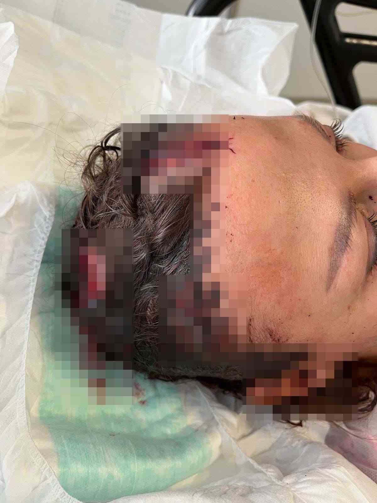 Uzaklaştırma kararı bulunan eşe sopalı saldırı davasında savcıdan 20 yıla kadar hapis talebi
