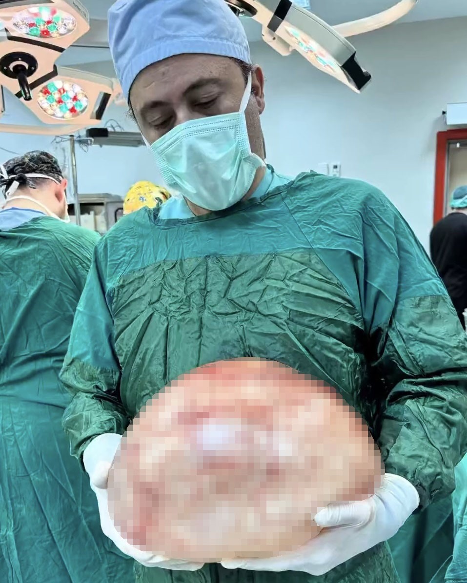 Van’da bir kadının karnından 35 santimetrelik dev kitle çıkarıldı
