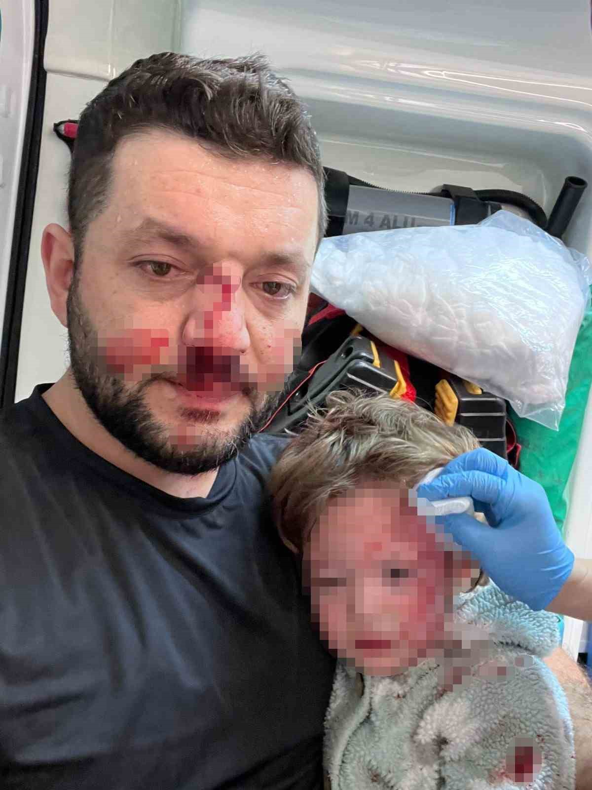 Yalova’da baba ve 14 aylık kızına scotter ile saldıran zanlının 36 yıla kadar hapsi istendi
