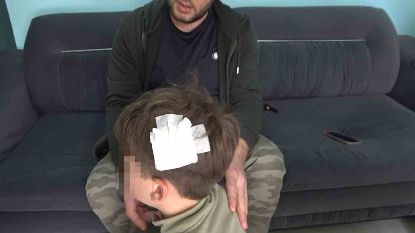 Yalova’daki komşu kavgasında bu kez 8 yaşındaki çocuğa taşlı saldırı
