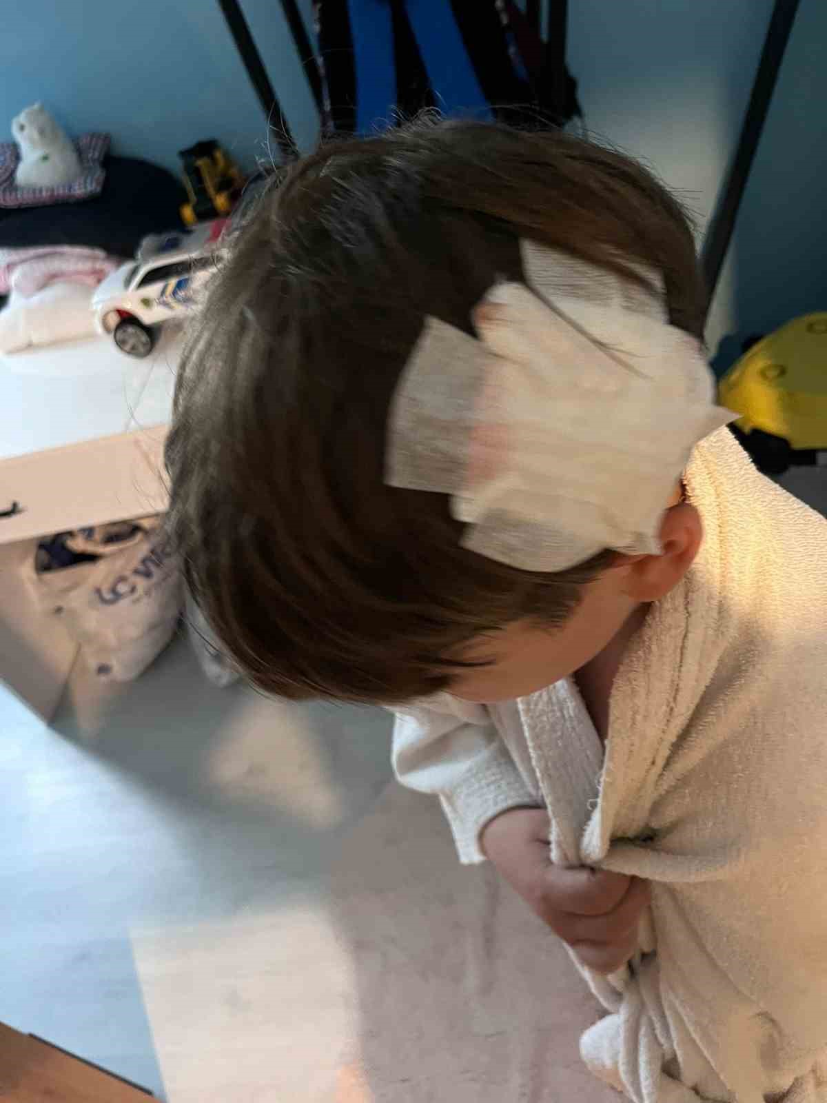 Yalova’daki komşu kavgasında bu kez 8 yaşındaki çocuğa taşlı saldırı
