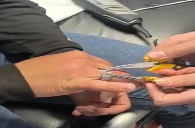 Batman’da parmağa sıkışan yüzük itfaiye ekiplerince çıkarıldı
