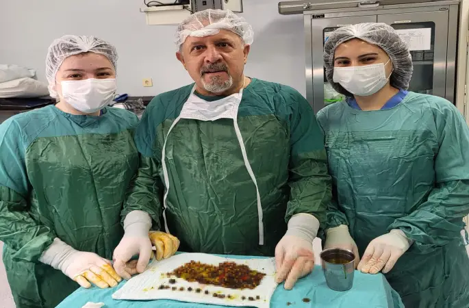 Karın ağrısıyla gitti, safrasından binlerce taş çıktı
