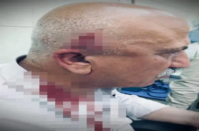 Kerkük’te kaçak yapı yıkımı sırasında kaymakama bıçaklı ve sopalı saldırı
