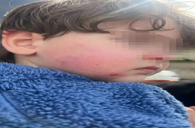 Kreşe bıraktığı çocuğunu darp edilmiş halde aldı
