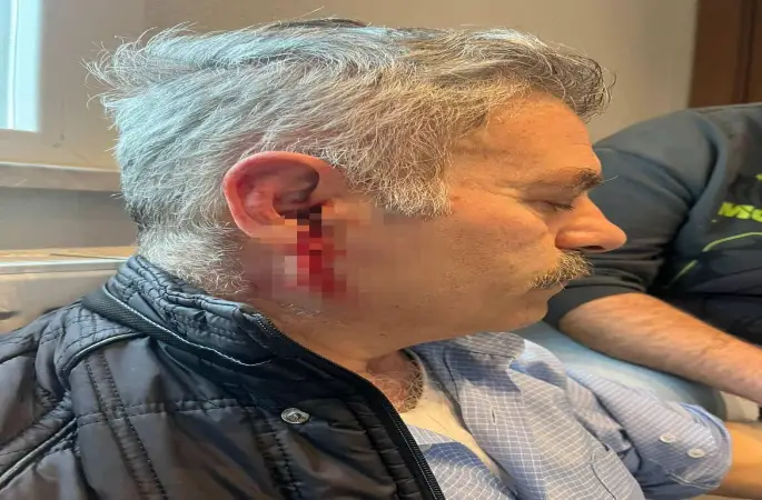 Silivri’de özel bakım merkezine çağrılan eski çalışan darbedildi
